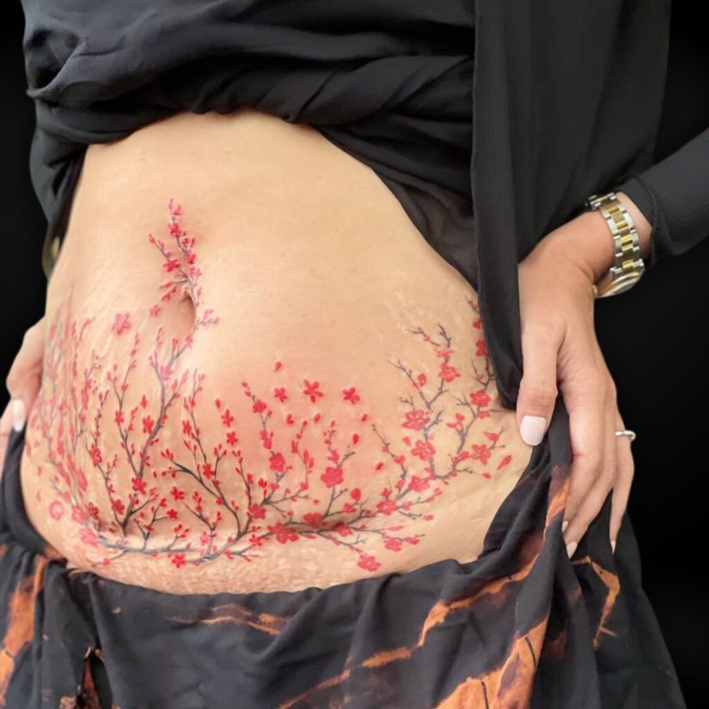 floral tattoo over scars